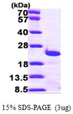 SDS-PAGE: Recombinant Human Centrin 3 His Protein [NBP1-48345]