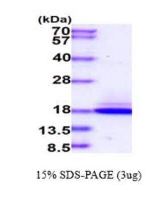 SDS-PAGE: Recombinant Human Chemerin His Protein [NBP2-77505]