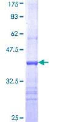 SDS-PAGE: Recombinant Human Choline Acetyltransferase/ChAT GST (N-Term) Protein [H00001103-Q01]