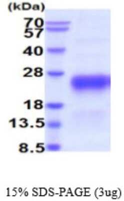 SDS-PAGE: Recombinant Human Chorionic Gonadotropin beta Chain (hCG beta) His Protein [NBP2-59545]