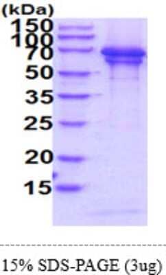 SDS-PAGE: Recombinant Human Chromogranin A His Protein [NBP2-61453]