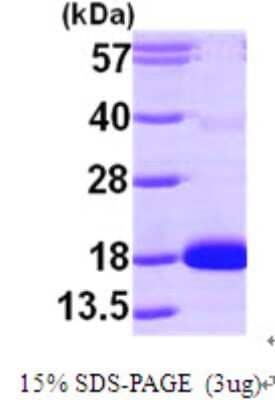 SDS-PAGE: Recombinant Human Citidine Deaminase His Protein [NBP1-49306]