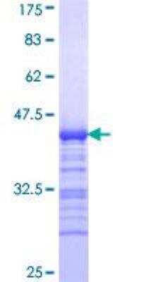 SDS-PAGE: Recombinant Human Citron Kinase GST (N-Term) Protein [H00011113-Q01]