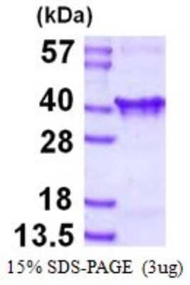 SDS-PAGE: Recombinant Human Clathrin light chain His Protein [NBP1-98967]