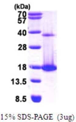 SDS-PAGE: Recombinant Human Coactosin-like Protein 1/CotL1 His Protein [NBP1-50942]