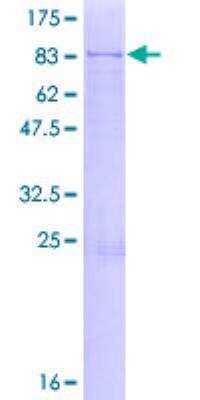 SDS-PAGE: Recombinant Human Coatomer Subunit Delta GST (N-Term) Protein [H00000372-P01]