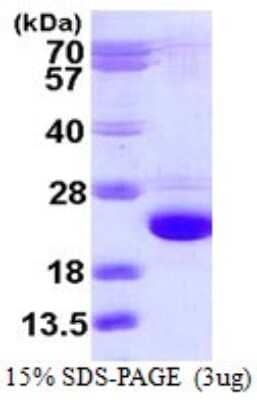 SDS-PAGE: Recombinant Human Cofilin 2 His Protein [NBP1-72427]