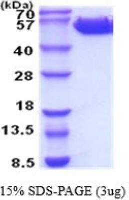 SDS-PAGE: Recombinant Human Common beta Chain His Protein [NBP2-52244]