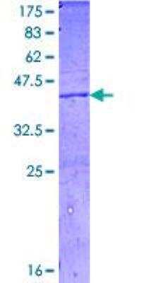 SDS-PAGE: Recombinant Human Complement C4a GST (N-Term) Protein [H00000720-Q01]