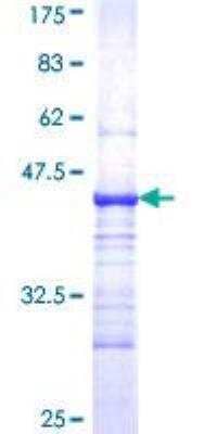 SDS-PAGE: Recombinant Human Complement C4b GST (N-Term) Protein [H00000721-Q01]