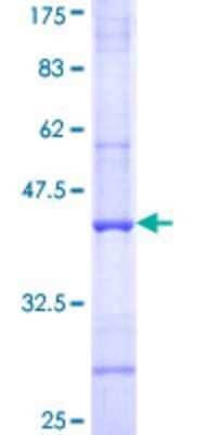 SDS-PAGE: Recombinant Human Complement C4b GST (N-Term) Protein [H00000721-Q02]