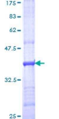 SDS-PAGE: Recombinant Human Complement C5 GST (N-Term) Protein [H00000727-Q01]