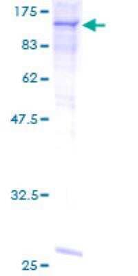 SDS-PAGE: Recombinant Human Complement C6 GST (N-Term) Protein [H00000729-P01]