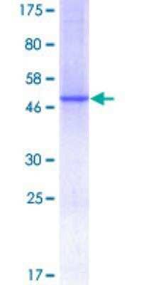 SDS-PAGE: Recombinant Human Complement Component C1qC GST (N-Term) Protein [H00000714-P01]