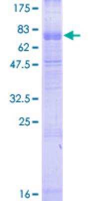 SDS-PAGE: Recombinant Human Complement Component C3aR GST (N-Term) Protein [H00000719-P01]