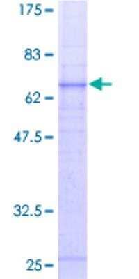 SDS-PAGE: Recombinant Human Complement Component C5aR1 GST (N-Term) Protein [H00000728-P01]