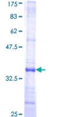 SDS-PAGE: Recombinant Human Complement Component C5aR1 GST (N-Term) Protein [H00000728-Q01]