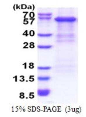 SDS-PAGE: Recombinant Human Complement Factor B His Protein [NBP2-22796]