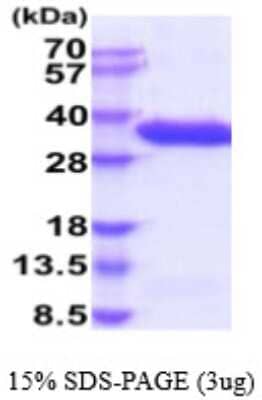 SDS-PAGE: Recombinant Human Complement Factor B His Protein [NBP2-59529]