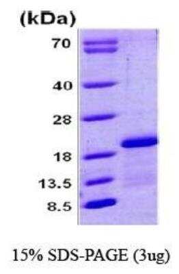 SDS-PAGE: Recombinant Human Complexin-1 His Protein [NBC1-18349]