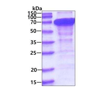 SDS-PAGE: Recombinant Human Cornulin His Protein [NBP1-41224]