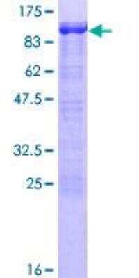 SDS-PAGE: Recombinant Human Cortactin GST (N-Term) Protein [H00002017-P01]