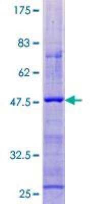 SDS-PAGE: Recombinant Human Cortistatin GST (N-Term) Protein [H00001325-P01]