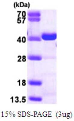 SDS-PAGE: Recombinant Human CrkL His Protein [NBP1-50941]