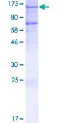 SDS-PAGE: Recombinant Human CtIP GST (N-Term) Protein [H00005932-P01]