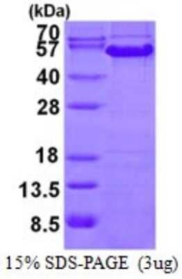 SDS-PAGE: Recombinant Human Cyclin A2 His Protein [NBP1-98953]