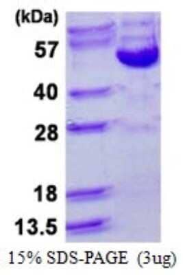 SDS-PAGE: Recombinant Human Cyclin B2 His Protein [NBP1-98946]