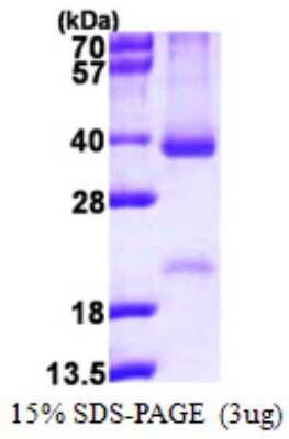 SDS-PAGE: Recombinant Human Cyclin D2 His Protein [NBP1-78841]