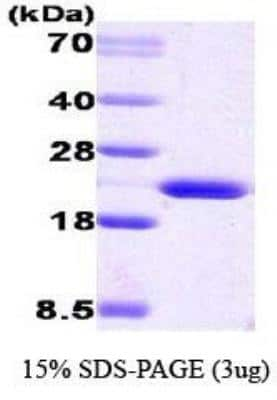 SDS-PAGE: Recombinant Human Cyclophilin B Protein [NBC1-18424]