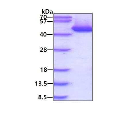 SDS-PAGE: Recombinant Human Cystathionase His Protein [NBP1-78832]