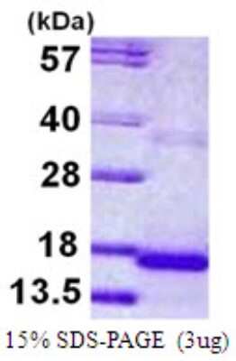 SDS-PAGE: Recombinant Human Cystatin-9 His Protein [NBP1-78812]