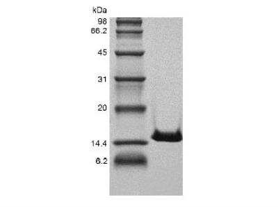 SDS-PAGE: Recombinant Human Cystatin C Protein [NBP2-61381]