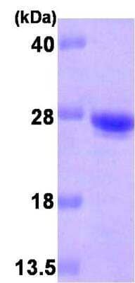 SDS-PAGE: Recombinant Human Cysteine Dioxygenase Type 1 His Protein [NBP1-30241]