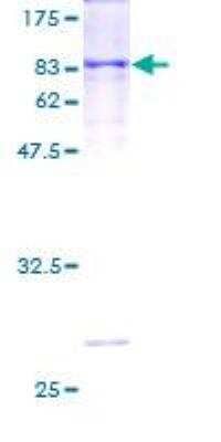 SDS-PAGE: Recombinant Human Cytochrome P450 1A1 GST (N-Term) Protein [H00001543-P01]