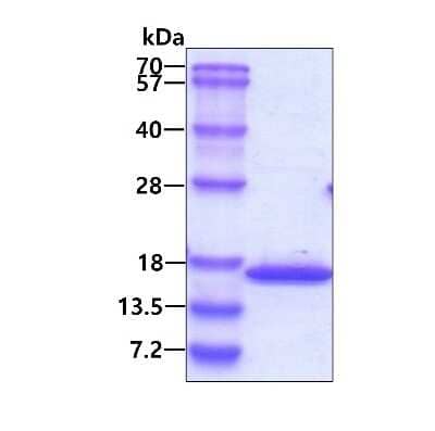 SDS-PAGE: Recombinant Human Cytochrome b5 type A His Protein [NBP1-72422]