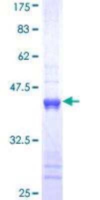 SDS-PAGE: Recombinant Human Cytokeratin 1 GST (N-Term) Protein [H00003848-Q01]