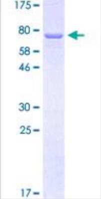 SDS-PAGE: Recombinant Human Cytokeratin 12 GST (N-Term) Protein [H00003859-P01]