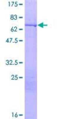 SDS-PAGE: Recombinant Human Cytokeratin 16 GST (N-Term) Protein [H00003868-P01]