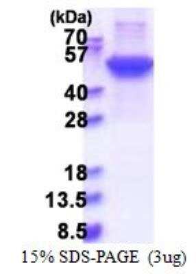 SDS-PAGE: Recombinant Human Cytokeratin 17 His Protein [NBP2-51594]