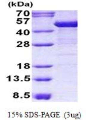 SDS-PAGE: Recombinant Human Cytokeratin 19 His Protein [NBP2-23164]