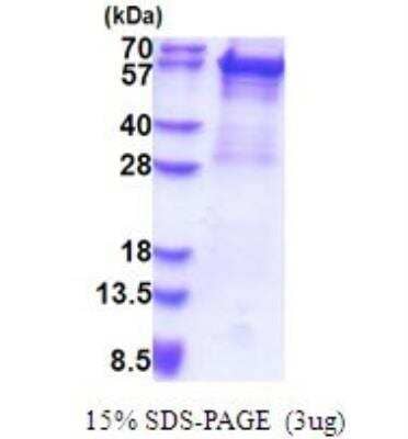 SDS-PAGE: Recombinant Human Cytokeratin 5 His Protein [NBP2-51653]