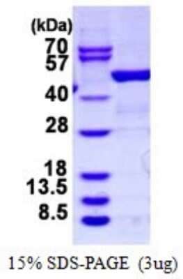 SDS-PAGE: Recombinant Human D4-GDI/RhoGDI2 His Protein [NBP1-99054]