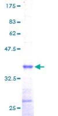 SDS-PAGE: Recombinant Human DAD1 GST (N-Term) Protein [H00001603-P01]