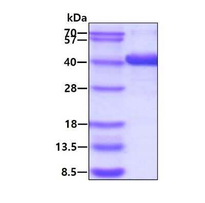 SDS-PAGE: Recombinant Human DAO His Protein [NBC1-28774]