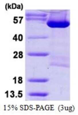 SDS-PAGE: Recombinant Human DARS His Protein [NBP1-99067]