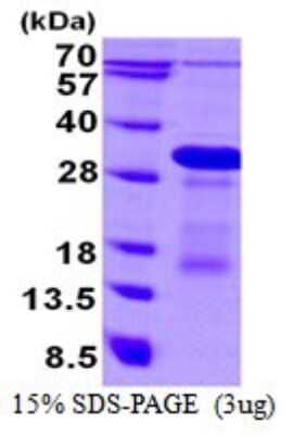 SDS-PAGE: Recombinant Human DBNDD1 His Protein [NBP1-98889]